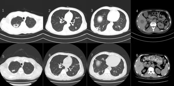 电竞分析：空洞骑士：丝之歌》难度曲线分析 秋季赛前瞻 iOS专业版 系统解析