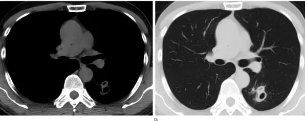 《空洞骑士：丝之歌》装备强化指南 9月技术分析 Xbox Series X 地图解析